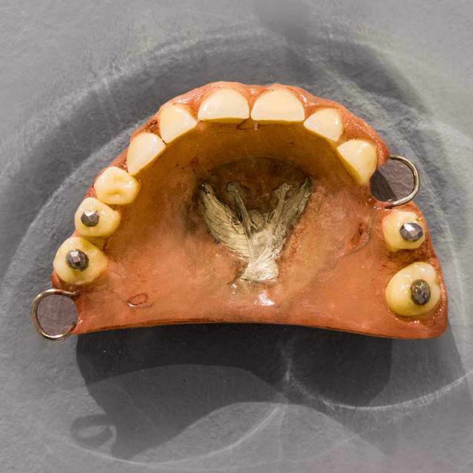 Claudio Correa, Bling Bling (detalle), 2017, 69 piezas compuestas por medallas y prótesis dentales con incrustaciones metálicas. Cortesía del artista